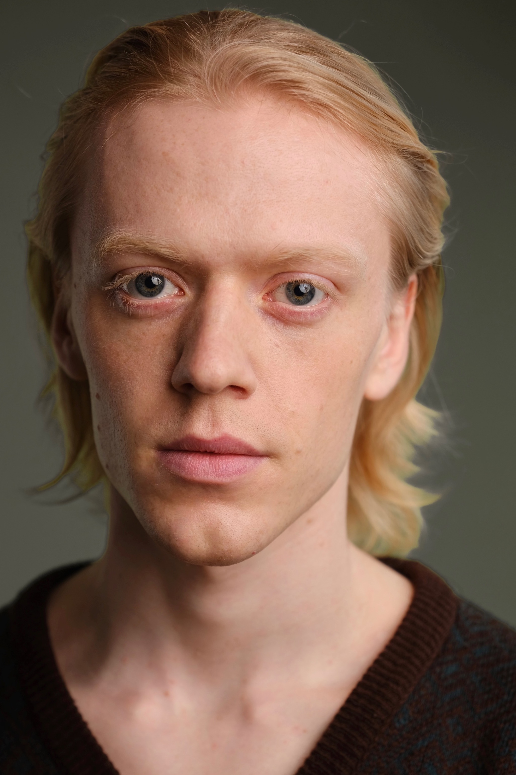 PETER TODD - Represented by Jo Hole Associates